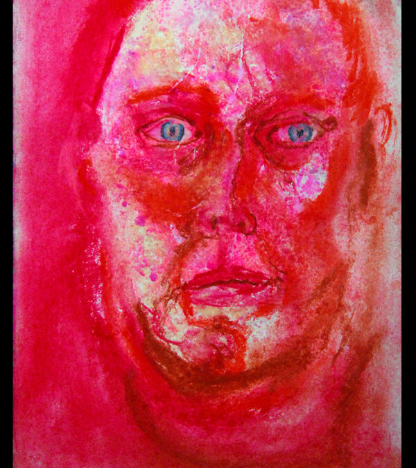 Psychosis
